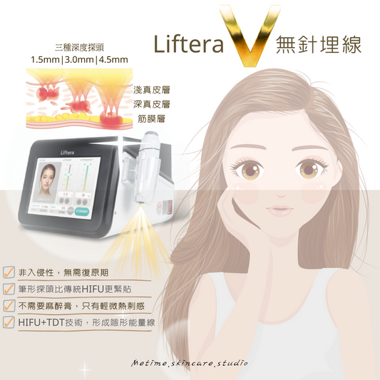 Liftera V 無針埋線